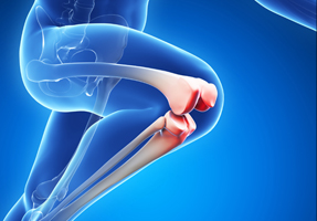 Physiotherapy for Osteoarthritis Treatment