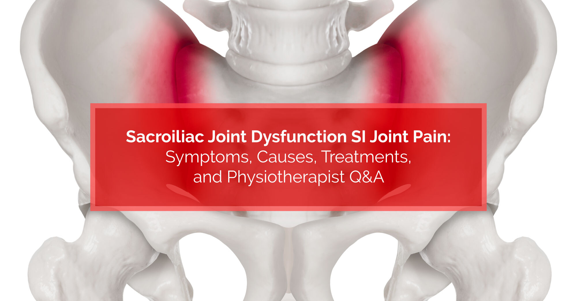hente Medalje Dental Sacroiliac Joint Dysfunction & SI Joint Pain: Symptoms, Causes, Treatments,  and Physiotherapist Q&A | Physiomed